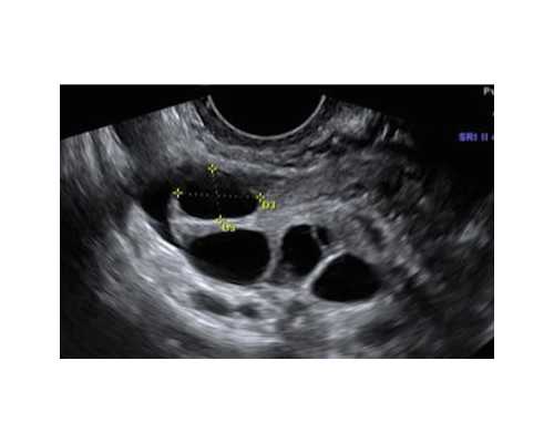 新疆助孕试管助孕服务,新疆助孕试管助孕服务公司