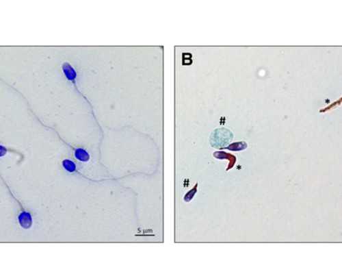 北京代怀中心地址,北京试管费用可以医保报销吗？北京试管医院挑选方法